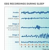 hippocampus memory consolidation